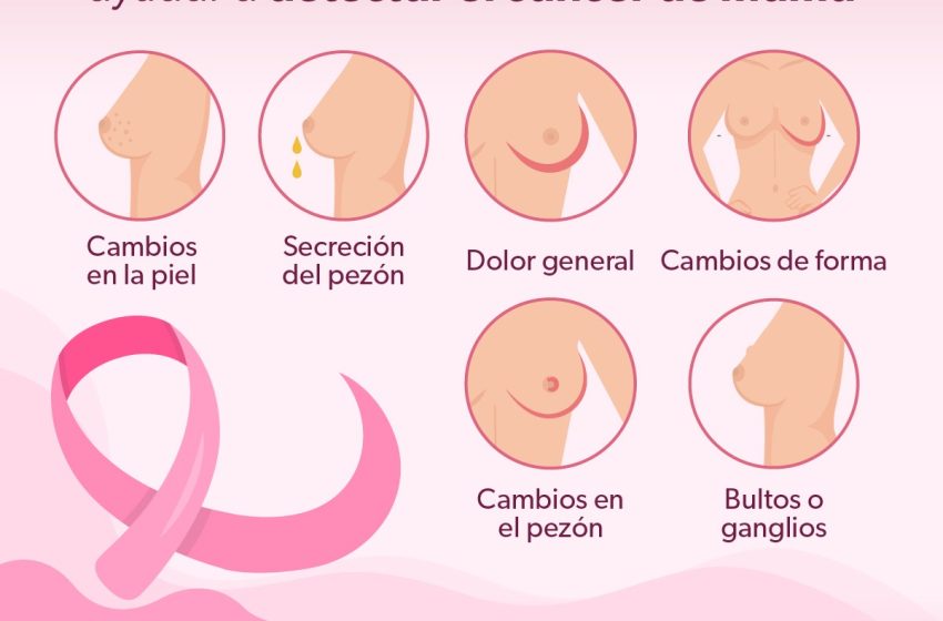  Conoce los síntomas que indican la presencia de cáncer de mama
