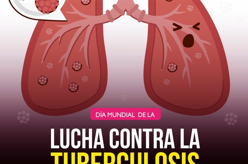  Prevención y detección, claves para combatir la tuberculosis: SSM